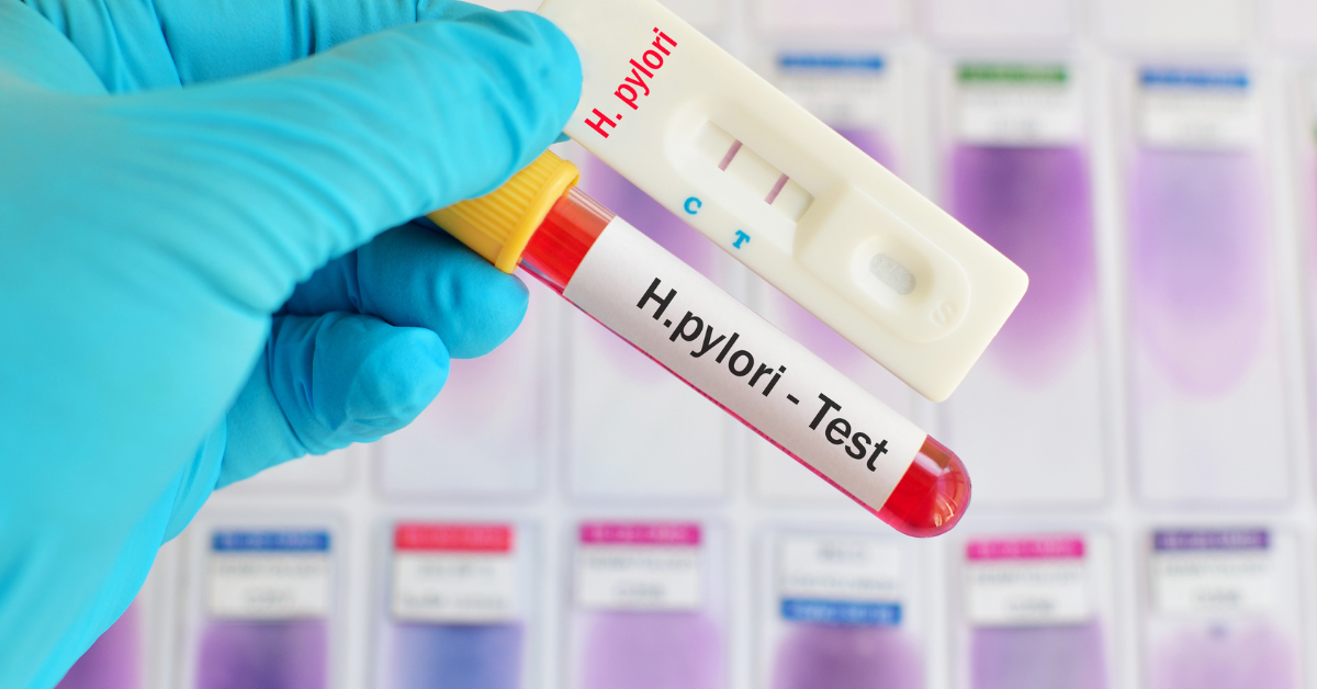 H Pylori sample